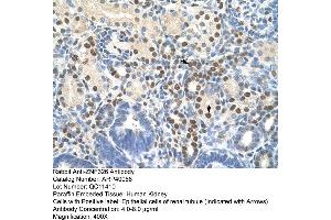 Image no. 2 for anti-Zinc Finger Protein 326 (ZNF326) (C-Term) antibody (ABIN2778596)