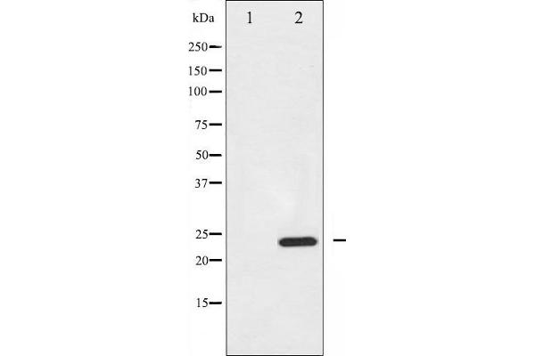 anti-BCL2-Interacting Killer (Apoptosis-Inducing) (BIK) antibody