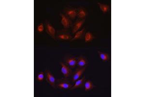 Immunofluorescence analysis of U2OS cells using  Rabbit pAb (ABIN3020671, ABIN3020672, ABIN1512605 and ABIN6213659) at dilution of 1:100 (40x lens).