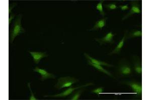 Image no. 5 for anti-Protein Phosphatase 2A Activator, Regulatory Subunit 4 (PPP2R4) (AA 1-323) antibody (ABIN519124)