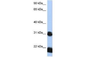 Image no. 1 for anti-Orthodenticle Homeobox 1 (OTX1) (N-Term) antibody (ABIN2792672)