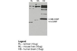 Image no. 3 for anti-Catechol-O-Methyltransferase (COMT) (Middle Region) antibody (ABIN2781821)