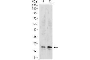Image no. 4 for anti-Nucleoside diphosphate kinase B (NME2) (AA 1-152), (full length) antibody (ABIN5542536)