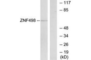 Image no. 1 for anti-Zinc Finger and SCAN Domain Containing 25 (ZSCAN25) (AA 331-380) antibody (ABIN1535501)