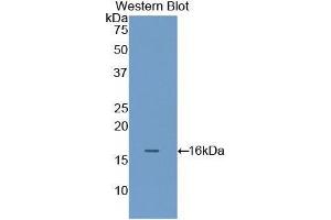 anti-Filamin B, beta (FLNB) (AA 2061-2193) antibody