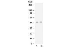 Image no. 2 for anti-Apolipoprotein B mRNA Editing Enzyme, Catalytic Polypeptide-Like 3G (APOBEC3G) antibody (ABIN5647471)