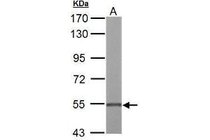 Image no. 3 for anti-UDP-Glucose 6-Dehydrogenase (UGDH) (Center) antibody (ABIN2856009)