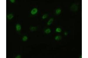 Image no. 1 for anti-Fibroblast Growth Factor 2 (Basic) (FGF2) (AA 104-251) antibody (ABIN5774788)