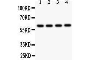 Image no. 1 for anti-Cell Adhesion Molecule 1 (CADM1) (AA 45-340) antibody (ABIN3043770)
