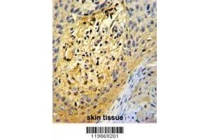 Image no. 2 for anti-Secreted Protein, Acidic, Cysteine-Rich (Osteonectin) (SPARC) (AA 224-251), (C-Term) antibody (ABIN390705)