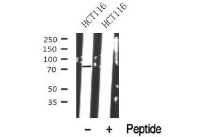 anti-Polo-Like Kinase 1 Substrate 1 (PLK1S1) (Internal Region) antibody