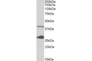 Image no. 2 for anti-Uroporphyrinogen Decarboxylase (UROD) (Internal Region) antibody (ABIN5539605)