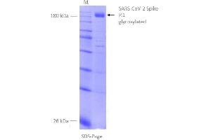 Image no. 3 for SARS-CoV-2 Spike (P.1 - gamma) protein (rho-1D4 tag) (ABIN6964443)