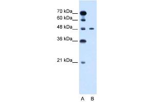 Image no. 2 for anti-Pre-B-Cell Leukemia Homeobox Protein 1 (PBX1) (N-Term) antibody (ABIN2777186)