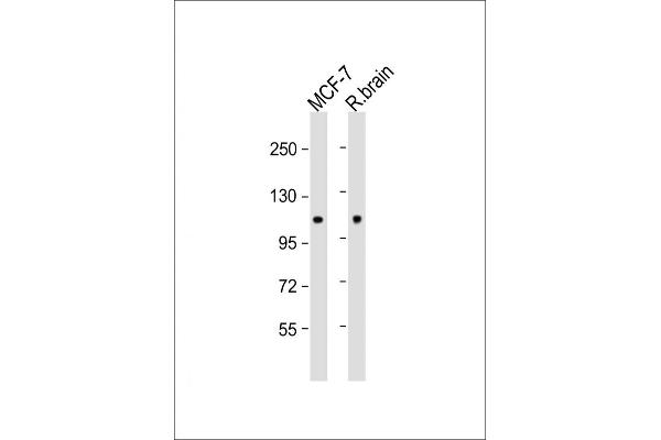 Hexokinase 1 antibody  (N-Term)