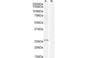 Image no. 5 for anti-Kallikrein 2 (KLK2) (Internal Region) antibody (ABIN190842)