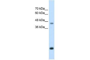 Image no. 2 for anti-Asporin (ASPN) (Middle Region) antibody (ABIN630167)