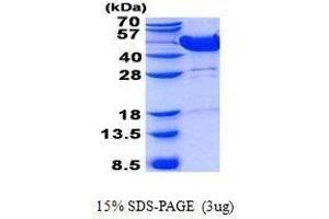 Image no. 1 for Mevalonate Kinase (MVK) protein (ABIN2130694)