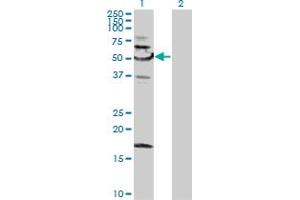 Image no. 1 for anti-Sorting Nexin 4 (SNX4) (AA 1-450) antibody (ABIN522168)