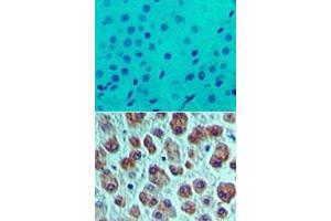 Image no. 1 for anti-Eukaryotic Translation Initiation Factor 4A1 (EIF4A1) (AA 350-400) antibody (ABIN960156)