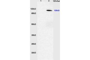 Image no. 2 for anti-Cylindromatosis (Turban Tumor Syndrome) (CYLD) (AA 390-440), (pSer418) antibody (ABIN683833)