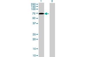 Image no. 1 for anti-Eukaryotic Translation Initiation Factor 2D (EIF2D) (AA 1-584) antibody (ABIN515175)