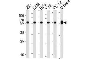 Image no. 2 for anti-Tubulin, beta 1 (TUBB1) antibody (ABIN3029340)