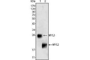 Image no. 2 for anti-Myosin, Light Chain 3 (MYL3) antibody (ABIN969303)