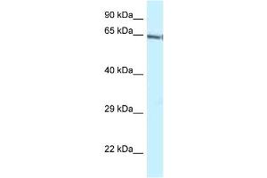 Image no. 1 for anti-GATA Zinc Finger Domain Containing 2B (GATAD2B) (C-Term) antibody (ABIN2781111)