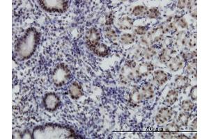 Immunoperoxidase of monoclonal antibody to MGC21874 on formalin-fixed paraffin-embedded human stomach.