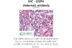 Image no. 1 for anti-Ubiquitin Specific Peptidase 4 (USP4) (Internal Region) antibody (ABIN1740613)
