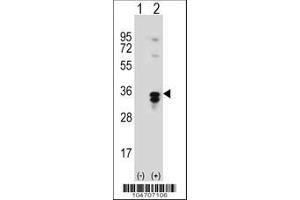 Image no. 3 for anti-Palmitoyl-Protein Thioesterase 1 (PPT1) (AA 269-300), (C-Term) antibody (ABIN389117)