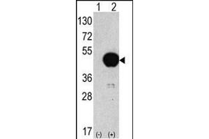 ATG4B Antikörper  (C-Term)