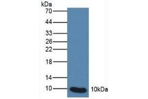 Detection of S100P in Human Leukocyte Cells using Polyclonal Antibody to S100 Calcium Binding Protein P (S100P)
