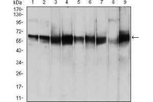 Image no. 4 for anti-3-phosphoinositide Dependent Protein Kinase-1 (PDPK1) (AA 457-556) antibody (ABIN5542259)