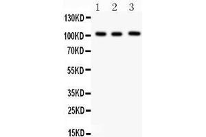 anti-Itchy E3 Ubiquitin Protein Ligase Homolog (ITCH) (AA 410-437), (Middle Region) antibody