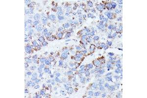 CCDC6 antibody  (AA 55-222)