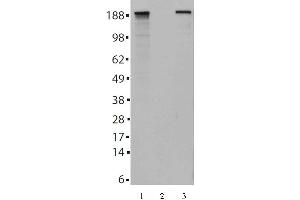 Image no. 1 for anti-Tet Methylcytosine Dioxygenase 2 (TET2) (AA 1-300) antibody (ABIN6972863)