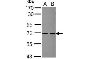 Image no. 1 for anti-Zinc Finger, SWIM-Type Containing 2 (ZSWIM2) (AA 350-575) antibody (ABIN1501868)