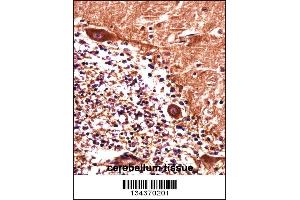 anti-Praja Ring Finger 1, E3 Ubiquitin Protein Ligase (PJA1) (N-Term) antibody