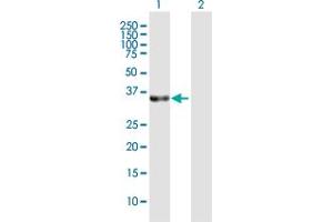 Image no. 3 for anti-Williams Beuren Syndrome Chromosome Region 22 (WBSCR22) (AA 1-281) antibody (ABIN530240)
