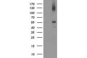 Image no. 3 for anti-LIM and Cysteine-Rich Domains 1 (LMCD1) antibody (ABIN2724852)