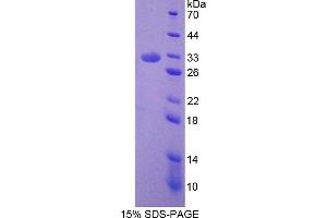 Image no. 1 for Septin 6 (SEPT6) (AA 87-327) protein (His tag) (ABIN6237132)