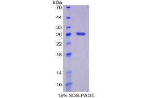 Image no. 1 for Damage-Specific DNA Binding Protein 2, 48kDa (DDB2) (AA 212-407) protein (His tag) (ABIN1879711)