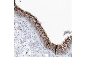 Image no. 2 for anti-Spermatogenesis Associated 18 (SPATA18) antibody (ABIN5588602)
