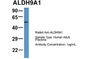 Image no. 2 for anti-Aldehyde Dehydrogenase 9 Family, Member A1 (ALDH9A1) (C-Term) antibody (ABIN2788130)