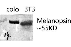 OPN4 antibody  (AA 400-480)