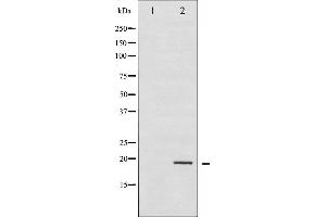 Image no. 2 for anti-Stathmin 1 (STMN1) (pSer25) antibody (ABIN6255120)