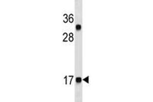 Image no. 2 for anti-Calcitonin-Related Polypeptide alpha (CALCA) (AA 104-132) antibody (ABIN3030253)