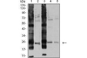 Image no. 1 for anti-V-Ral Simian Leukemia Viral Oncogene Homolog B (Ras Related, GTP Binding Protein) (Ralb) (AA 89-206) antibody (ABIN5542684)